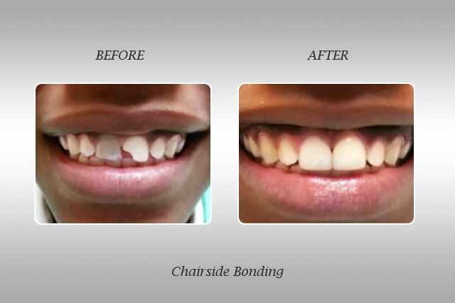 North Miami Smile Gallery