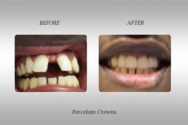 patient smile gallery in North Miami