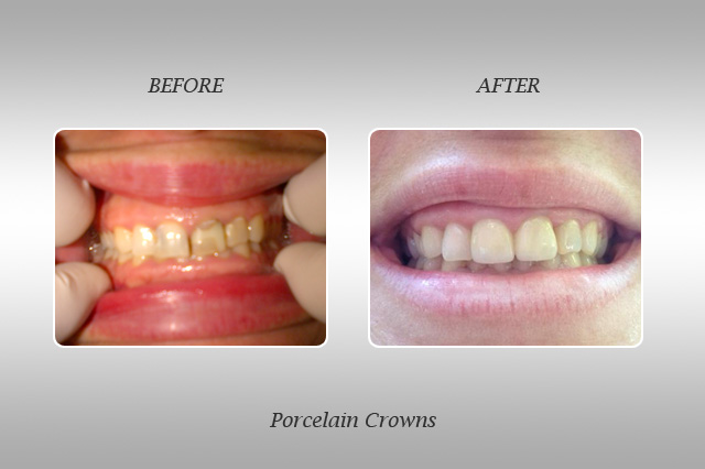 smile gallery in Lauderhill