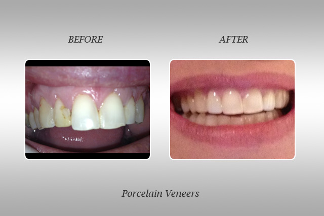 North Miami Smile Gallery