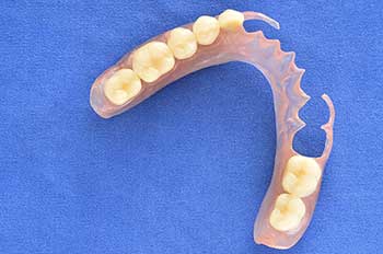 Removable Dentures in North Miami