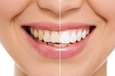 Cosmetic Dentistry Lauderhill