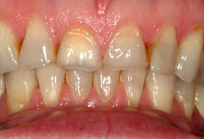 31419 Dental Photos